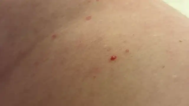 andrenoma427 online show from 13, 1, 2026